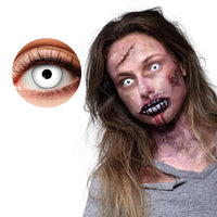 Infected Contact Lenses - image 2